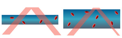 脈の立ち上がり、血流が多いときは赤血球が増え、光の透過を邪魔する。これを利用してフォトダイオードで脈を測るのが、脈拍センサの仕組み