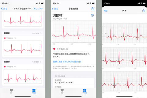 Apple Watchで心電図 おもちろ い ケータイ Watch